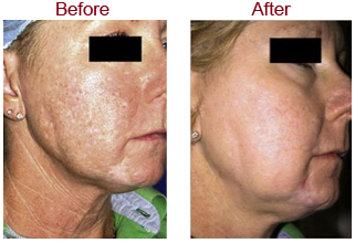 before and after cosmetic surgery images