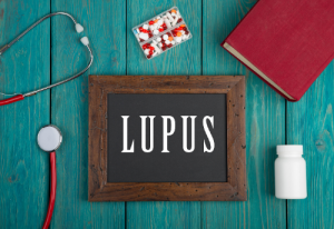 Lupus