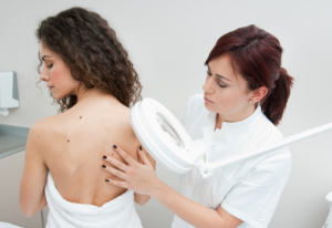 More Women Than Men Survive Melanoma?