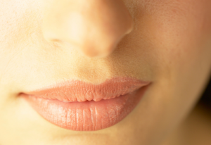 Erasing Lines Around Your Nose and Mouth