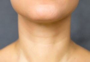 Look Younger Without Surgery or Downtime!