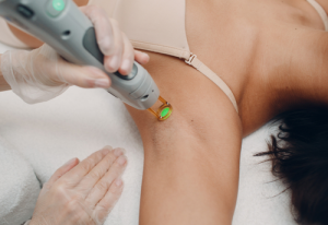 Laser Hair Removal: No Pain, Pure Gain