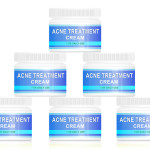 Acne treatment cream