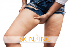 Tips For Reducing Cellulite
