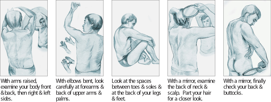 viewing body to detect skin cancer (illustrations)