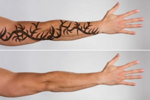 5 Risks of Getting a Tattoo