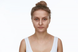 Ways to Make Dark Circles Disappear