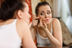 Acne Treatment, Female face
