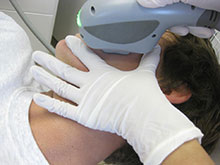Male face at acleara treatment
