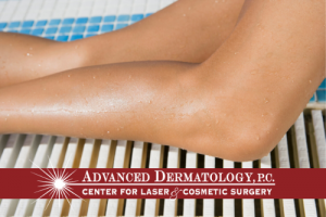 CoolSculpting at Advanced Dermatology, P.C.