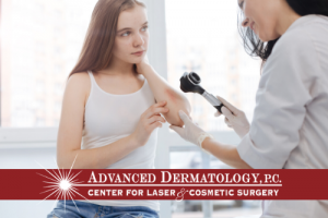 Jie Chen, RPA-C – Patient Experience at Advanced Dermatology, P.C.