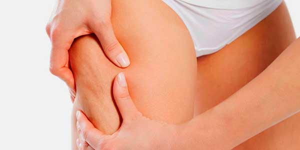 cellulite2