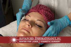 Jie Chen, RPA-C – Patient Experience at Advanced Dermatology, P.C.