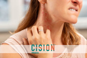 Is Your Red Rash an Allergic Reaction, Skin Irritation or Contact Dermatitis?