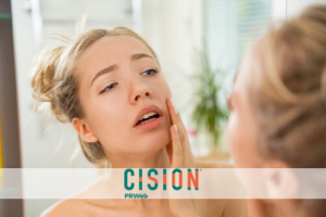 Understanding and treating oily skin