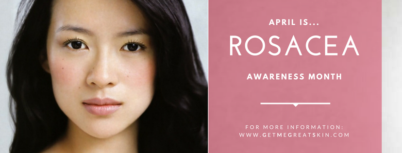 April is.... Rosacea awareness month - for more information: www.getmegreatskin.com