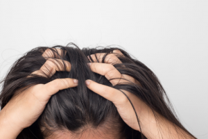 Suffering from One of the Most Common Scalp Conditions?