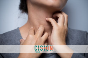 Missing Skin Proteins May Hold Key to Finding Cure for Eczema