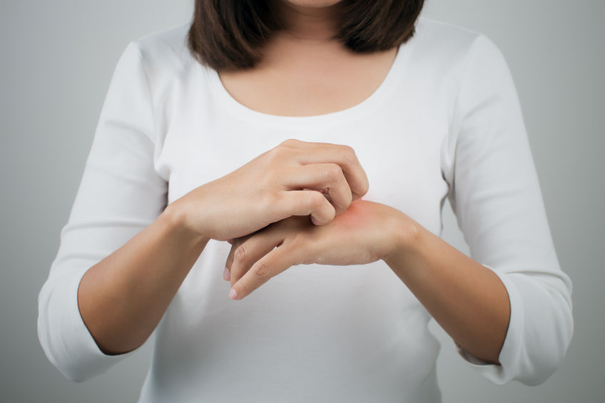 woman patient with eczema on hands