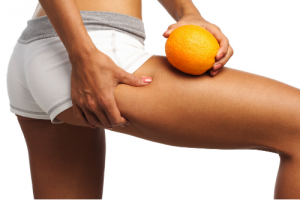 Smoothing Out Cellulite: What Really Works