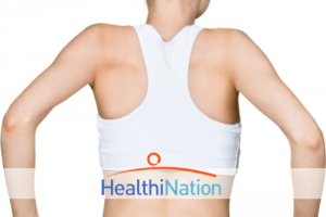 3 Signs Your Acne Is Actually Hidradenitis Suppurativa (HS)