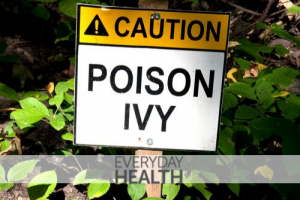 8 Tips for Getting Rid of Poison Ivy on Your Property