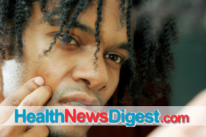 Some Acne Treatments ‘Suck’ – Literally