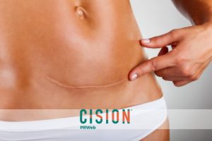 Lines of Defense: Understanding and Treating Scarred Skin
