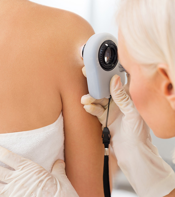 Actinic Keratosis Service Photo4