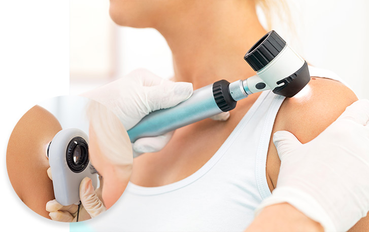 Actinic Keratosis Service Photo5