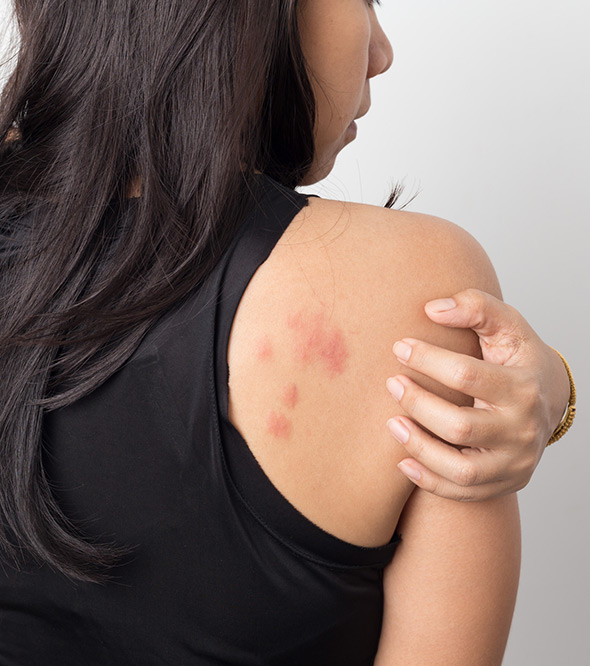 Eczema Service Photo8