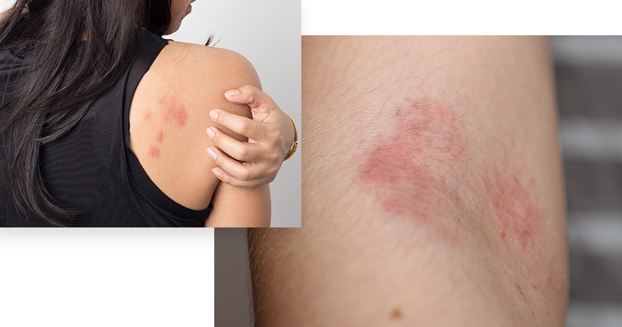 When Should You See An Allergist? Service Photo3