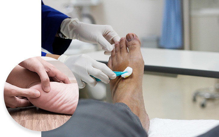 Genesis Laser (Toenail Fungus) Service Photo4