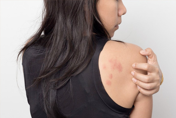 Dermatology and Allergist Go Hand In Hand Service Photo2