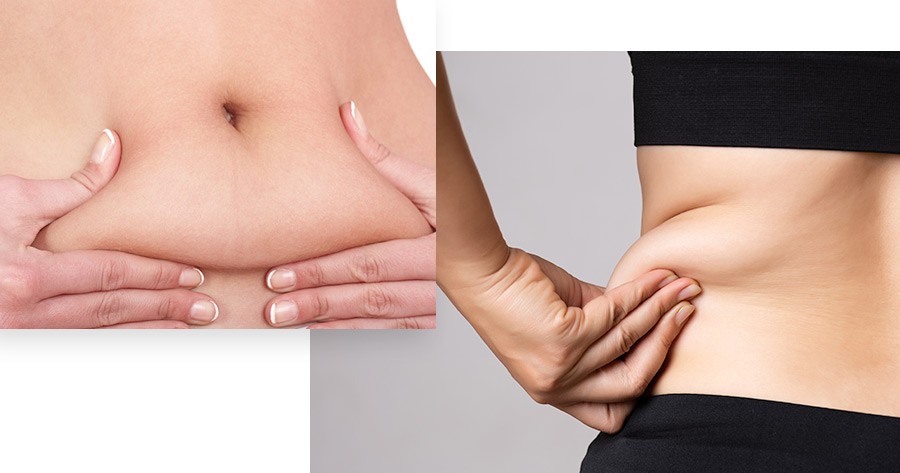 Non-Invasive Fat Removal Service Photo1