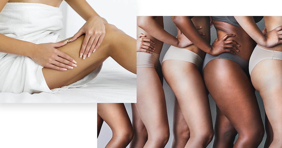 Medial Thigh Lift Service Photo1