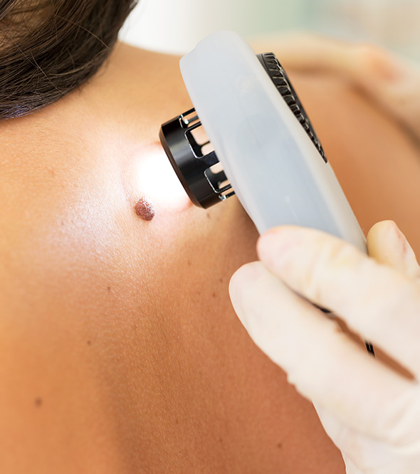 MOHS Skin Cancer Surgery Service Photo2