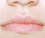 Laser Hair Removal patient after photo
