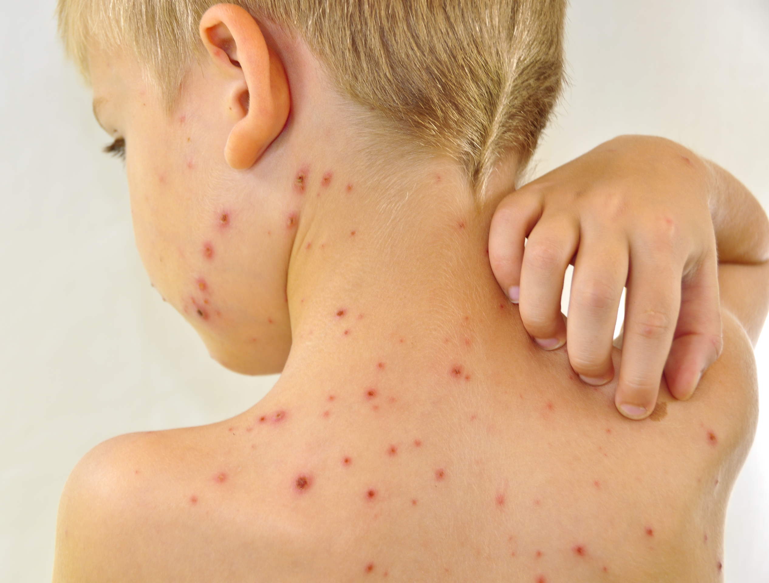 Contact Dermatitis Service Photo3