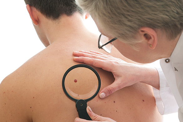 Dermatologist Summit, NJ Service Photo4
