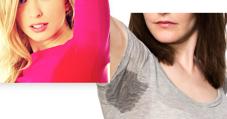 miraDry Underarm Sweating Treatment Summit, NJ Service Photo1