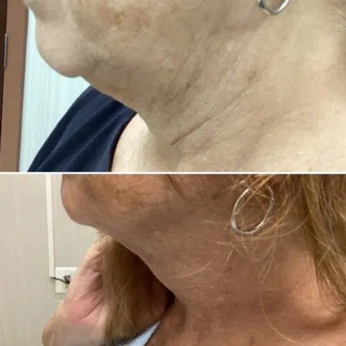 Before & After image