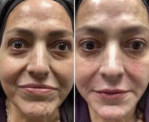 Before and After image