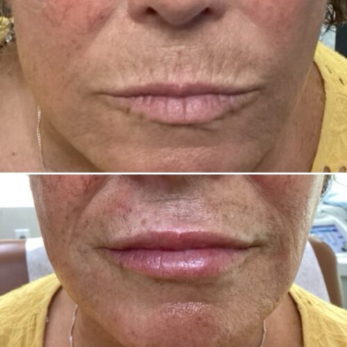 Before & After image