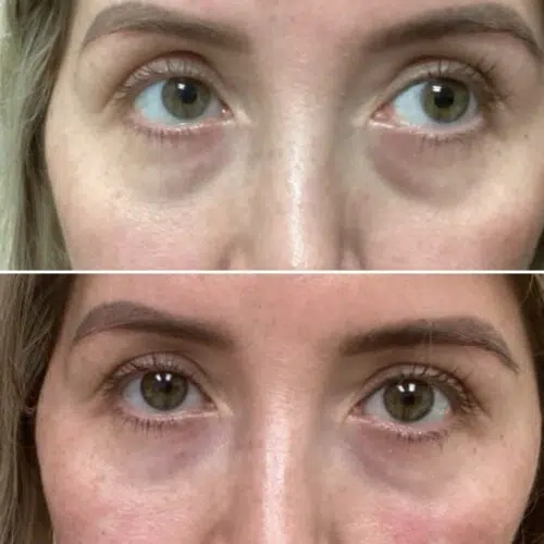 Before & After image 
