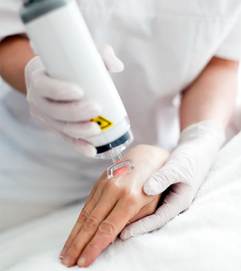 Best Laser Treatments to do During Winter