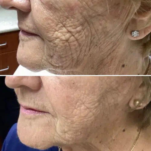 Before & After skin
