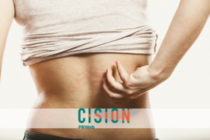 Dr. Derek V. Chan, Dermatologist with Advanced Dermatology PC, Shares Tips on Five Common Rash-Causing Skin Conditions