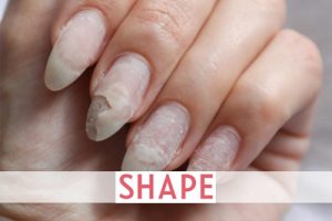 What It Means If You Have Peeling Nails (Plus, How to Fix Them)