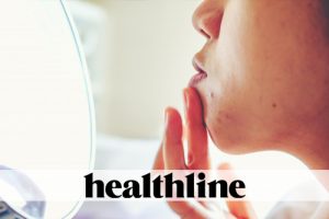 Whole in One: Treat Enlarged Pores and Give Your Skin an Overall Boost